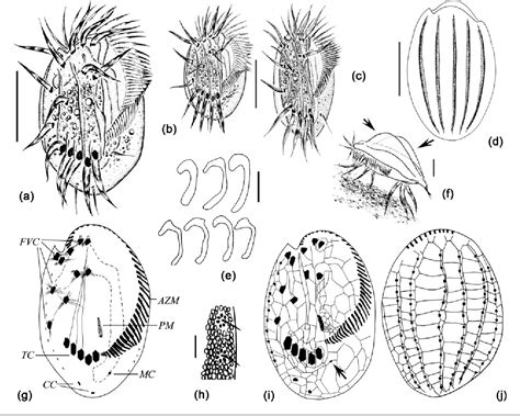  Euplotes! A Tiny Ciliate With An Enormous Appetite for Bacteria